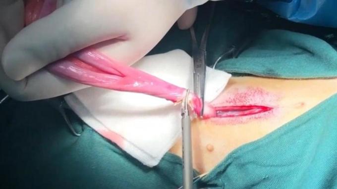 ultimo caso aziendale circa Utilizzo del bisturi ad ultrasuoni per animali domestici nella sterilizzazione del gatto e nella chirurgia neutra | Surgsci  0